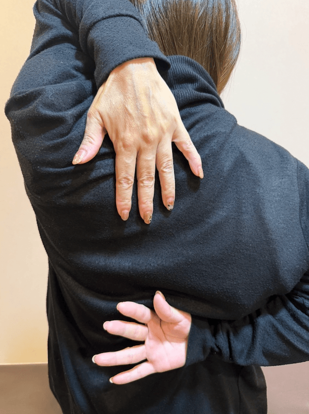 施術後の状態(After 3)